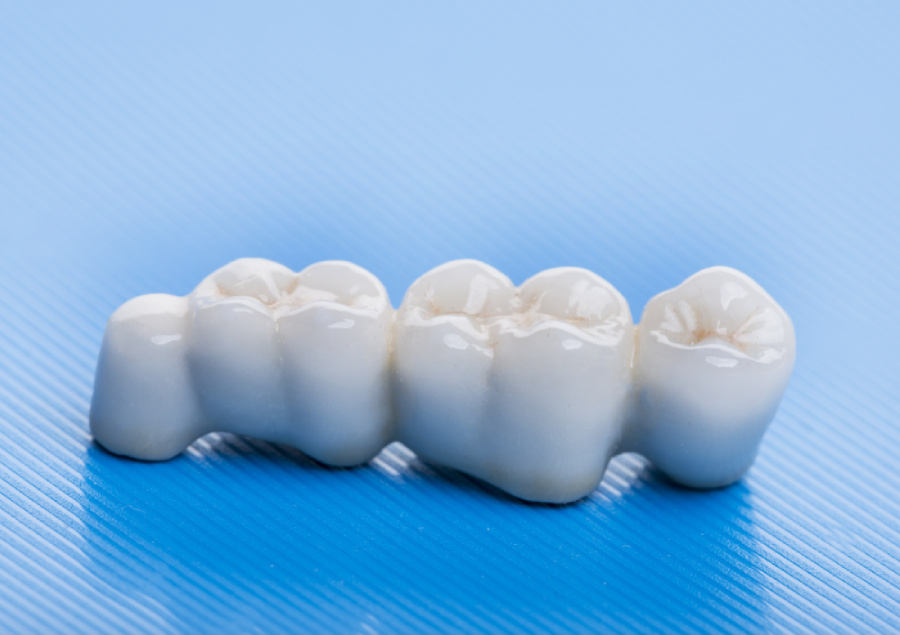 What is a Bridge Restorative Dentistry